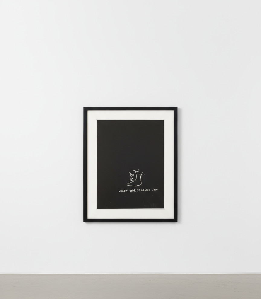 Jean-Michel Basquiat - Left Side of Lower Jaw, from Anatomy, 1982, Screen print