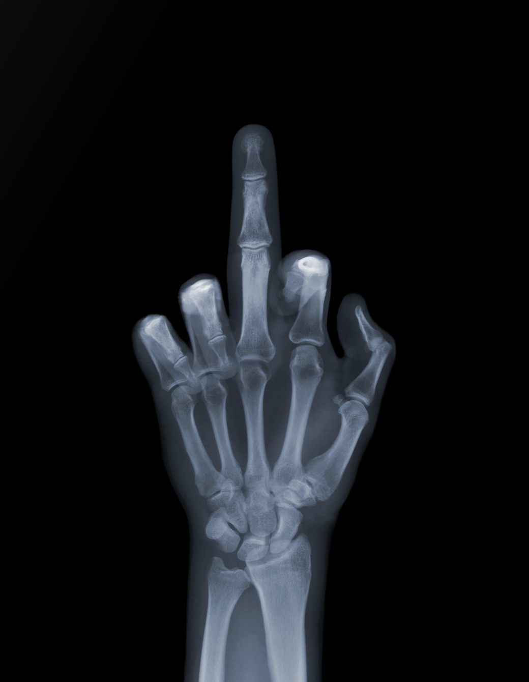 The Finger