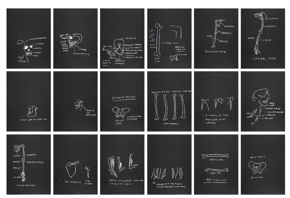 Jean-Michel Basquiat — Anatomy print series, 1982. Full set of 18 screenprints on black. | Guy Hepner